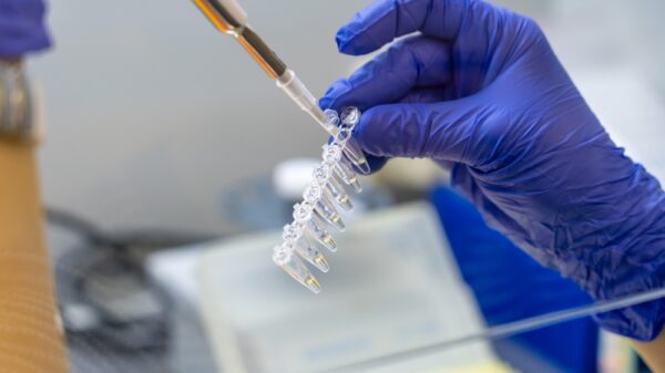 UE financia despistagem do vírus Mpox em África com 9,4 ME
